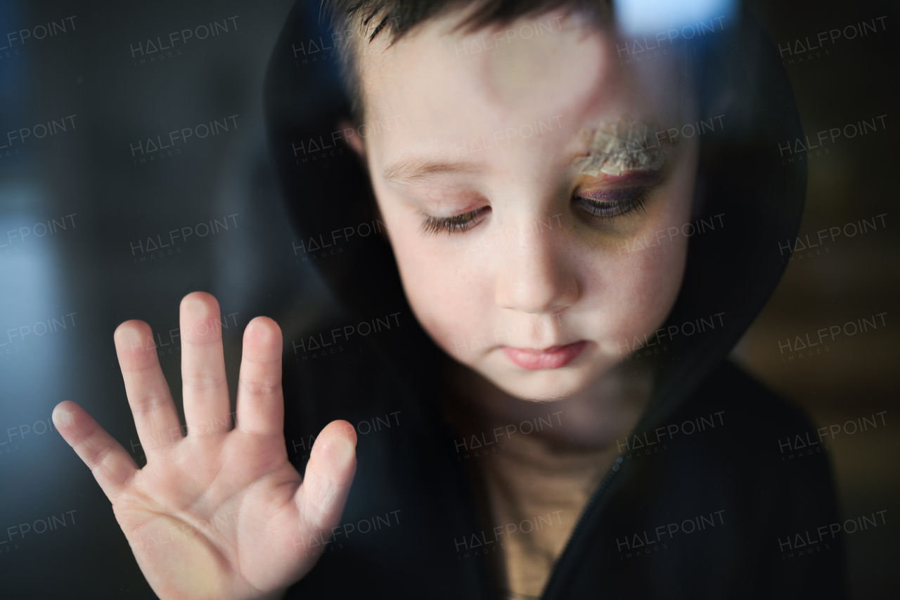 Poor sad small boy with cut eyebrow standing indoors at home, poverty concept. Shot through glass.