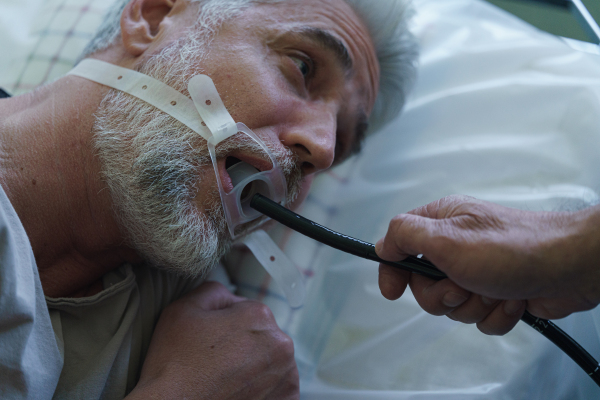 Gastroscopy procedure on sedated patient to examine upper digestive tract. Medical procedure.