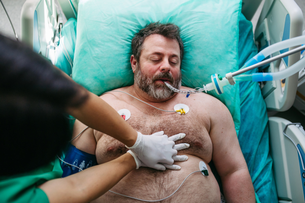 Medical team doing CPR on intubated patient in hospital.
