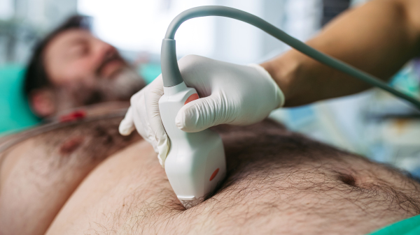 Close-up of doctor performing abdominal ultrasound on ICU patient.