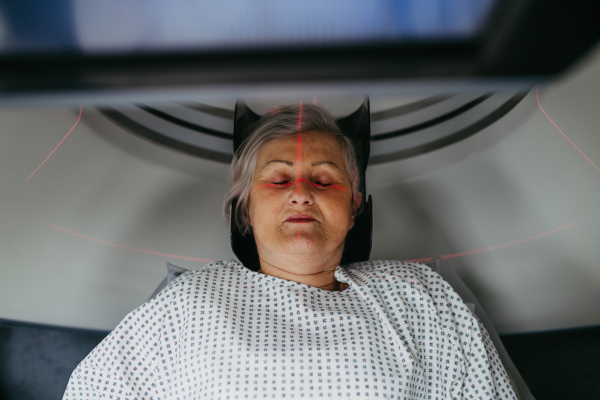 Top view of senior patient positioned for head scan with laser alignment in CT scanner